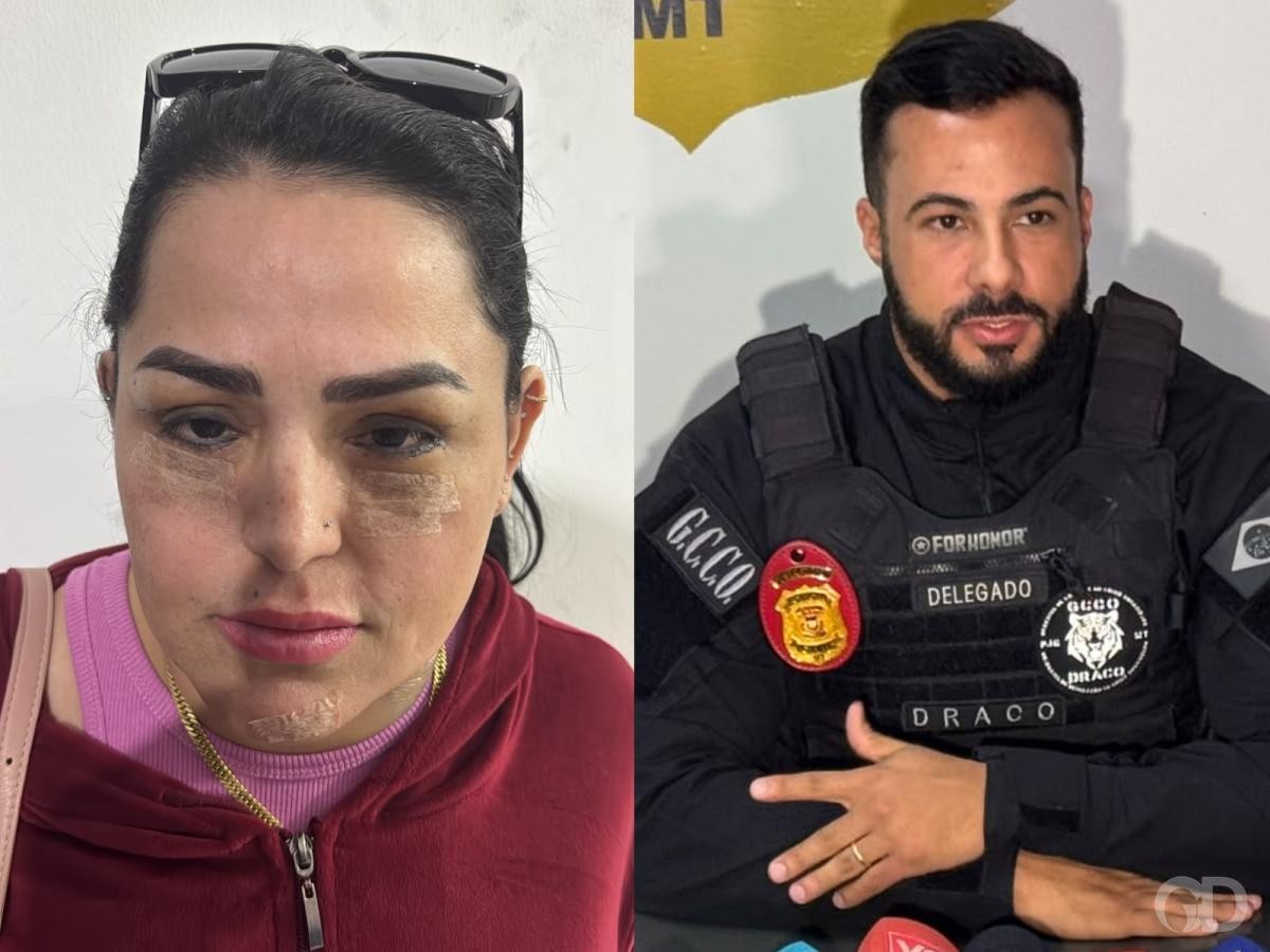 Faccionada fez 5 plásticas para mudar o rosto e continuar foragida, diz delegado